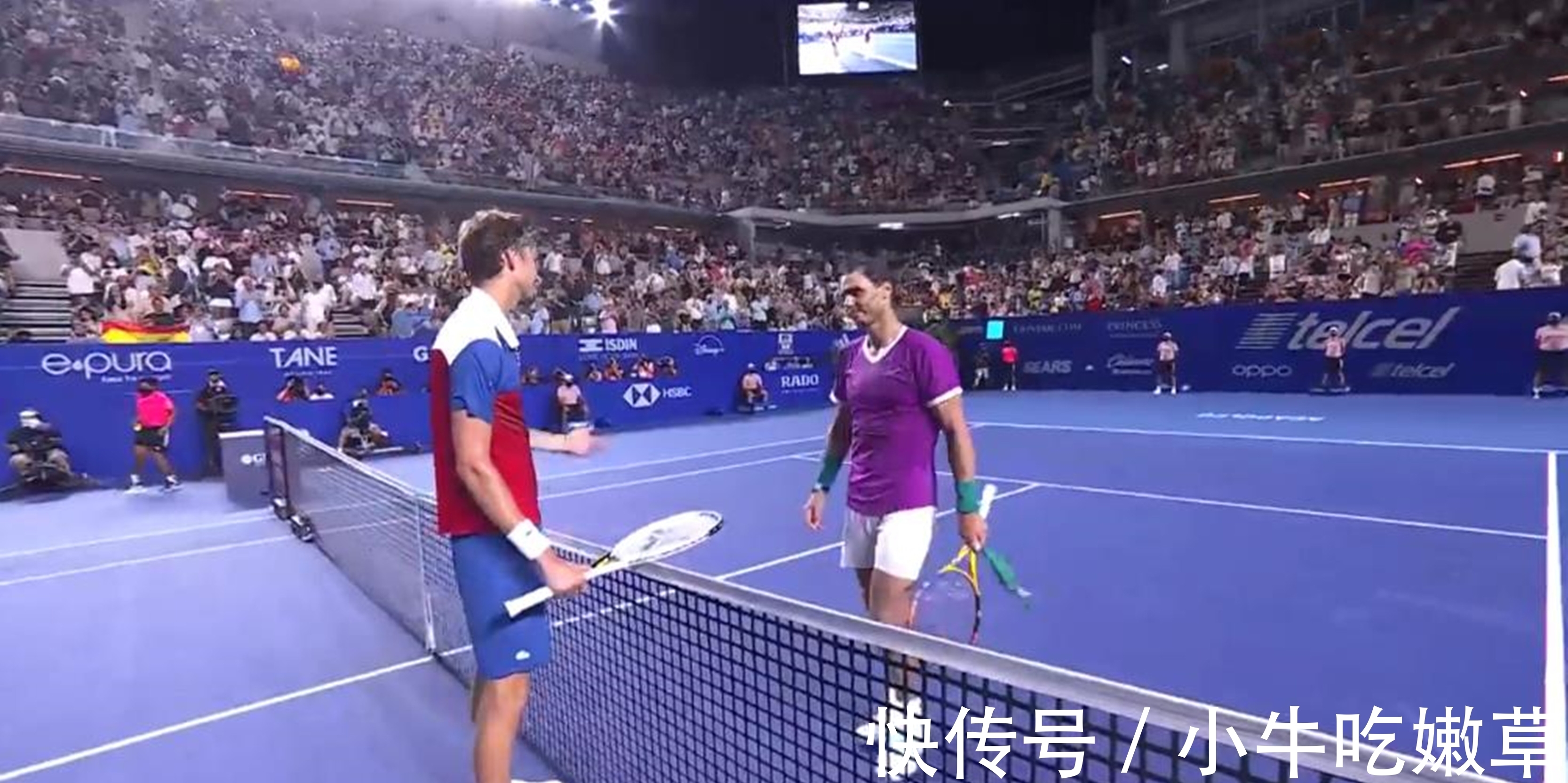 腕部差异很 腕部差异很